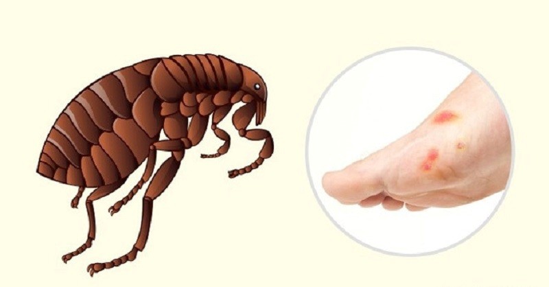 Các vết của bọ chét đốt thường xuất hiện trên chân