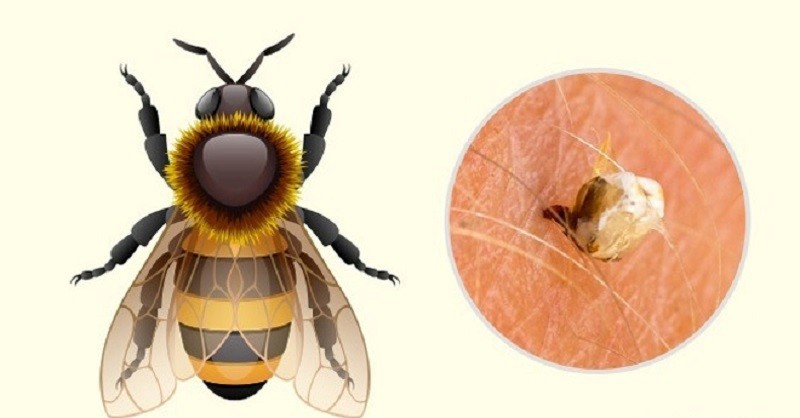 Vết mong mật đốt có điểm trắng nhỏ của ngòi ong ở giữa