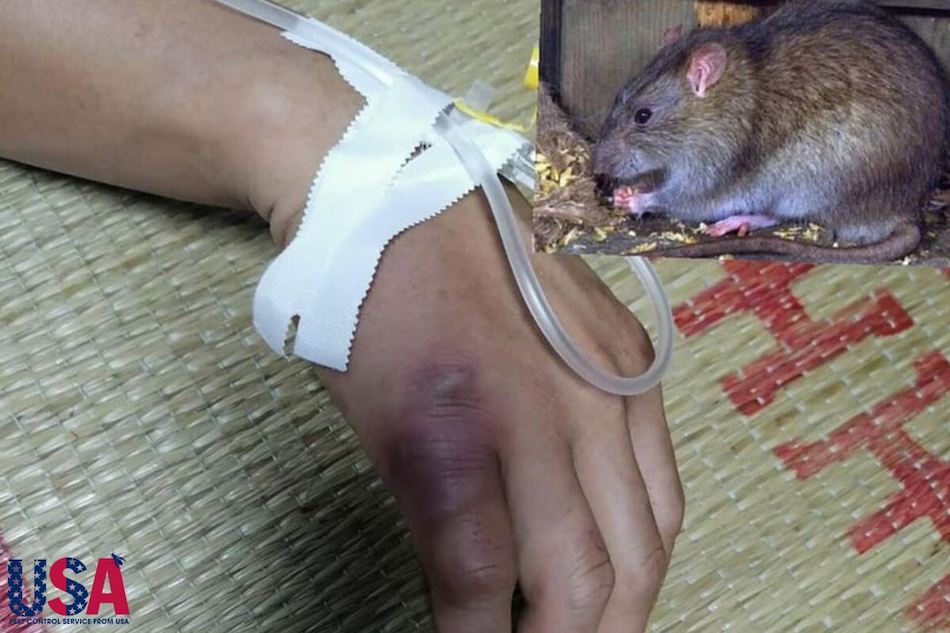 Chuột mang bệnh dịch hạch, có thể truyền sang con người khi bị cắn hoặc tiếp xúc